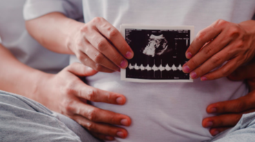 Four Dimension Ultrasound